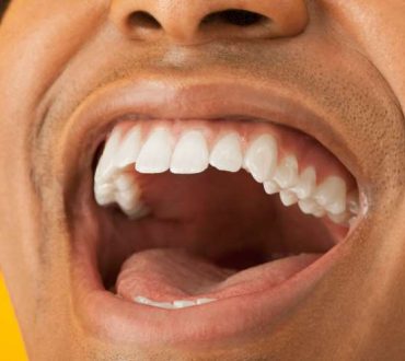 Καρκίνος του στόματος: Πώς να κάνετε αυτοεξέταση (Βίντεο)