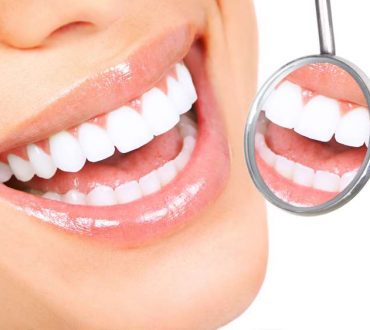 Φυσικοί τρόποι για να αφαιρέσετε την πλάκα από τα δόντια σας