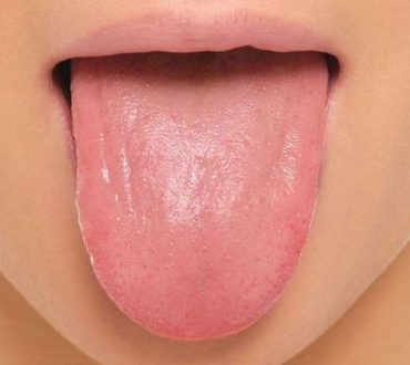 Γλώσσα: Ένας καθρέφτης της υγείας του στόματος