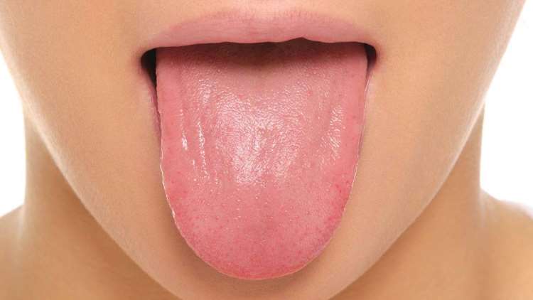 Γλώσσα: Ένας καθρέφτης της υγείας του στόματος