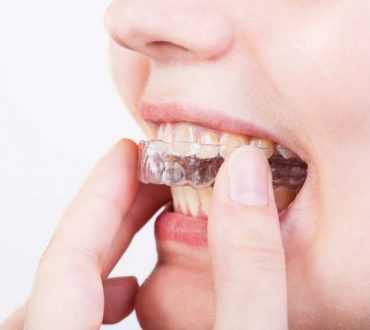 Τρίξιμο των δοντιών (βρουξισμός): 8 πιθανές αιτίες και τρόποι αντιμετώπισης