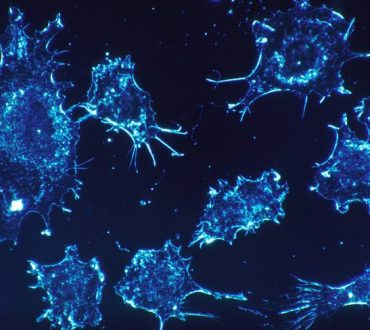 Νέα εξέταση υπόσχεται ανίχνευση του καρκίνου μέσα σε μόλις 10 λεπτά