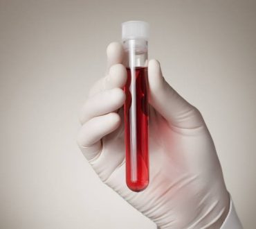 Νέα εξέταση αίματος εντοπίζει τον καρκίνο των ωοθηκών έως και δύο χρόνια νωρίτερα