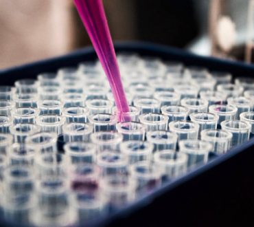 Ερευνητές αναπτύσσουν τεστ αίματος που εντοπίζει τον καρκίνο έως και 4 χρόνια πριν τα συνηθισμένα τεστ