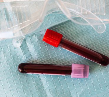 Μικροπλαστικά βρέθηκαν στο ανθρώπινο αίμα -Τι σημαίνει αυτό για εμάς