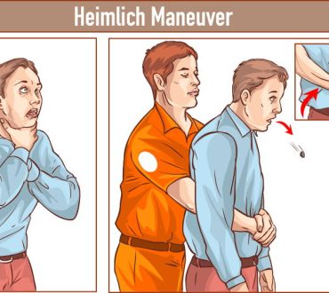 Mέθοδος Heimlich: Ποια είναι η λαβή που όλοι πρέπει να γνωρίζουμε και μπορεί να μας σώσει τη ζωή