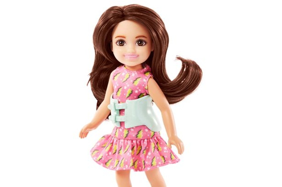 Η Barbie γράφει ιστορία λανσάροντας την πρώτη κούκλα με σκολίωση!