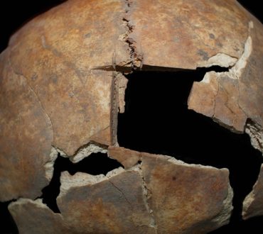 Ισραήλ: Bρέθηκαν στοιχεία χειρουργικής επέμβασης στον εγκέφαλο πριν από 3.500 χρόνια!