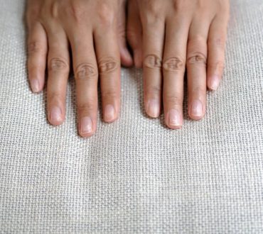 Γιατί ραγίζουν τα νύχια; Αιτίες και τρόποι θεραπείας