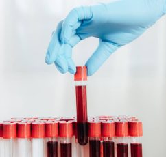 Σύνδρομο στρεπτοκοκκικού τοξικού σοκ: Ποια είναι τα συμπτώματα και οι τρόποι αντιμετώπισης