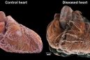 Έτοιμο το Google Earth της ανθρώπινης καρδιάς που εντοπίζει την πρώτη αιτία θανάτου (βίντεο)