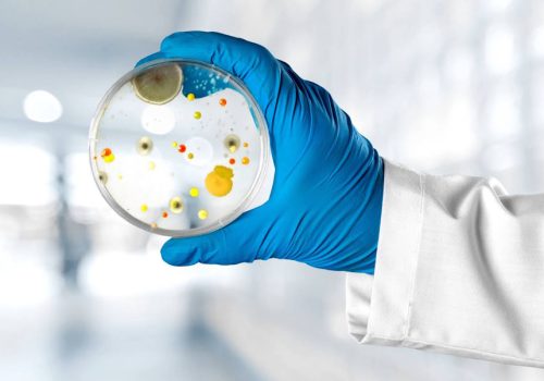 Τροφική δηλητηρίαση: Μικροβιολόγος εξηγεί τι πρέπει να προσέχουμε