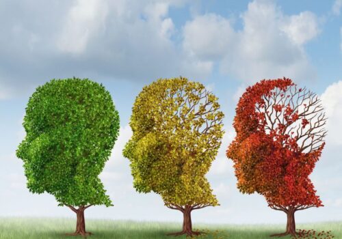 brain age